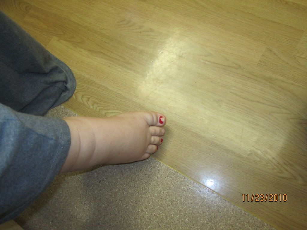 ugliest feet *contest* BabyGaga