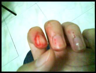 damn my bleeding hand
